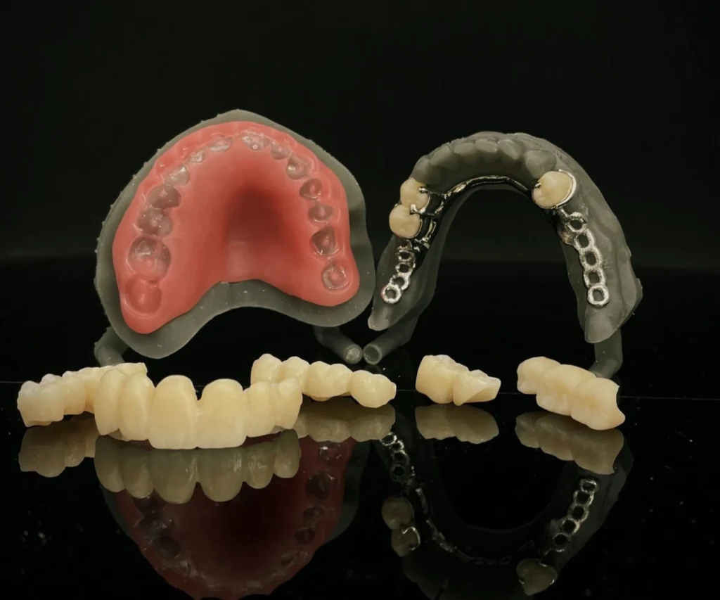 laboratoire dentaire dentotech bethune laboratoire dentaire dentotech bethune Notre métier Laboratoire dentaire DENTOTECH