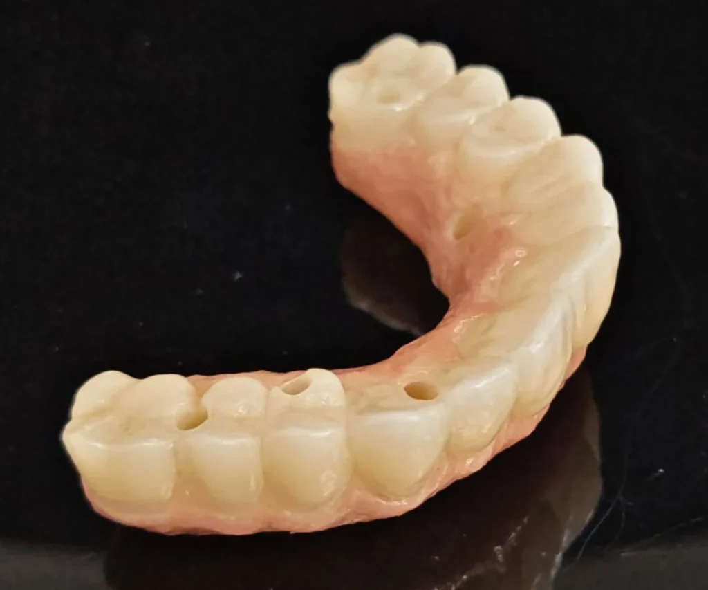 laboratoire dentaire dentotech bethune Prothèse adjointe Laboratoire dentaire DENTOTECH à Béthune