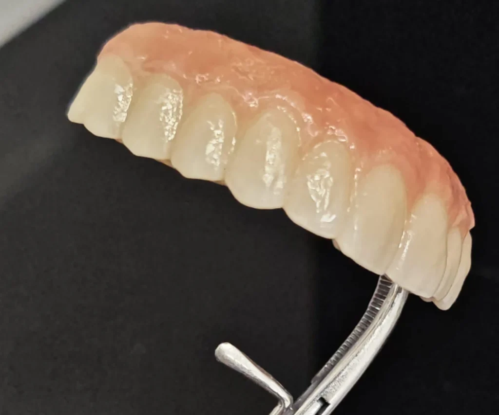 laboratoire dentaire dentotech bethune Notre métier Laboratoire dentaire DENTOTECH à Béthune