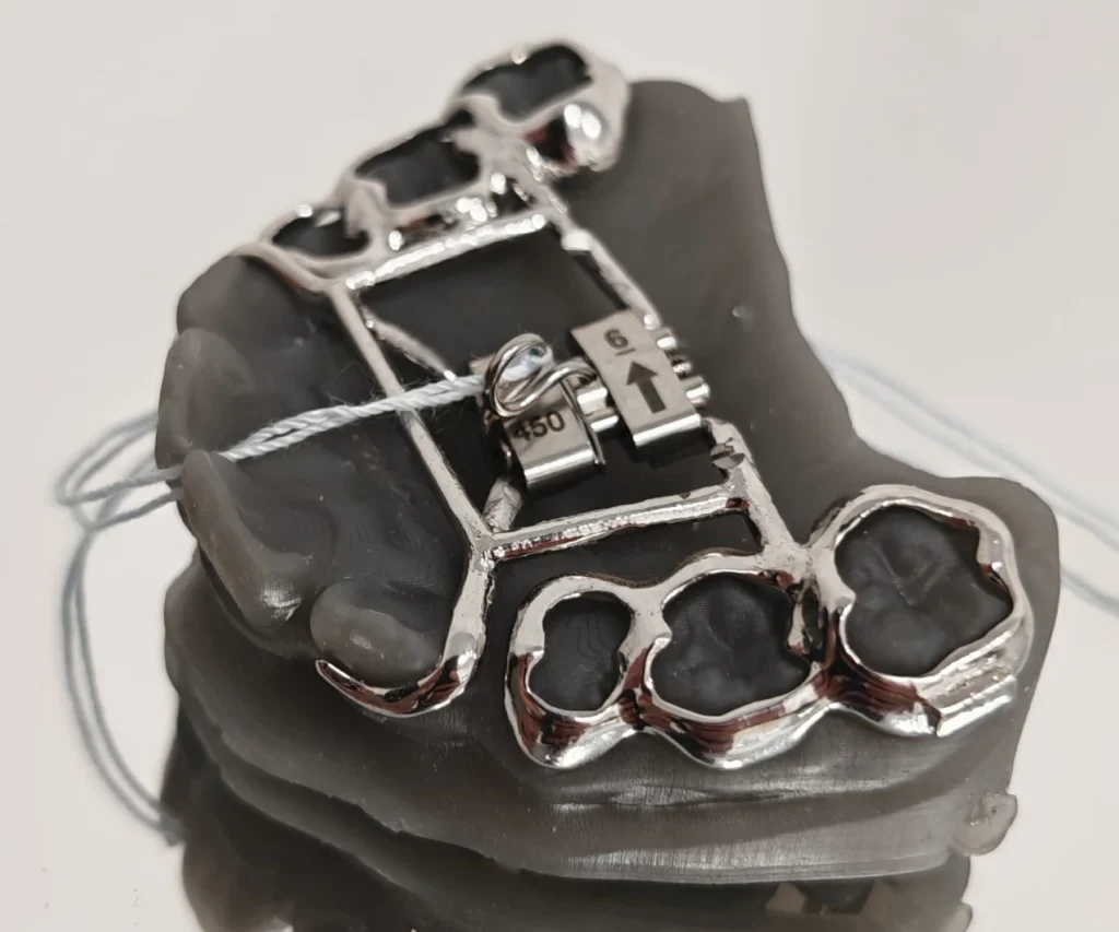 laboratoire dentaire dentotech bethune laboratoire dentaire dentotech bethune Appareils orthodontiques Laboratoire dentaire DENTOTECH à Béthune