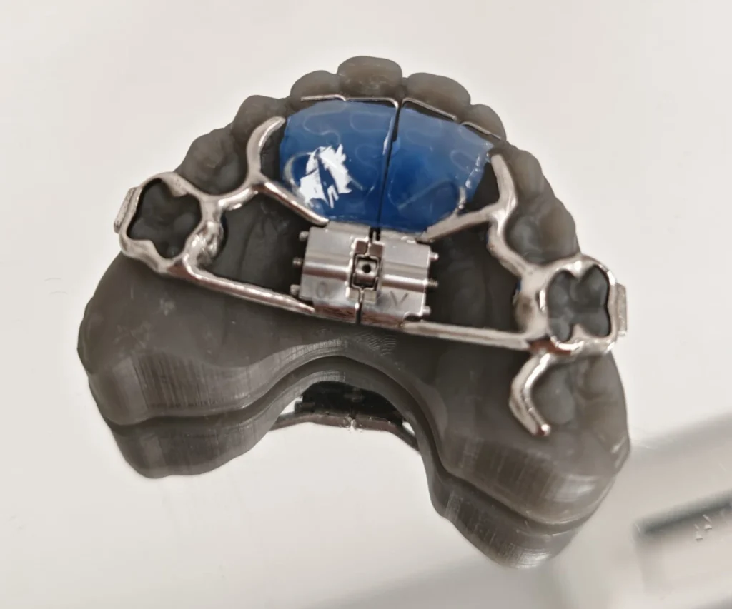 laboratoire dentaire dentotech bethune laboratoire dentaire dentotech bethune Appareils orthodontiques Laboratoire dentaire DENTOTECH à Béthune