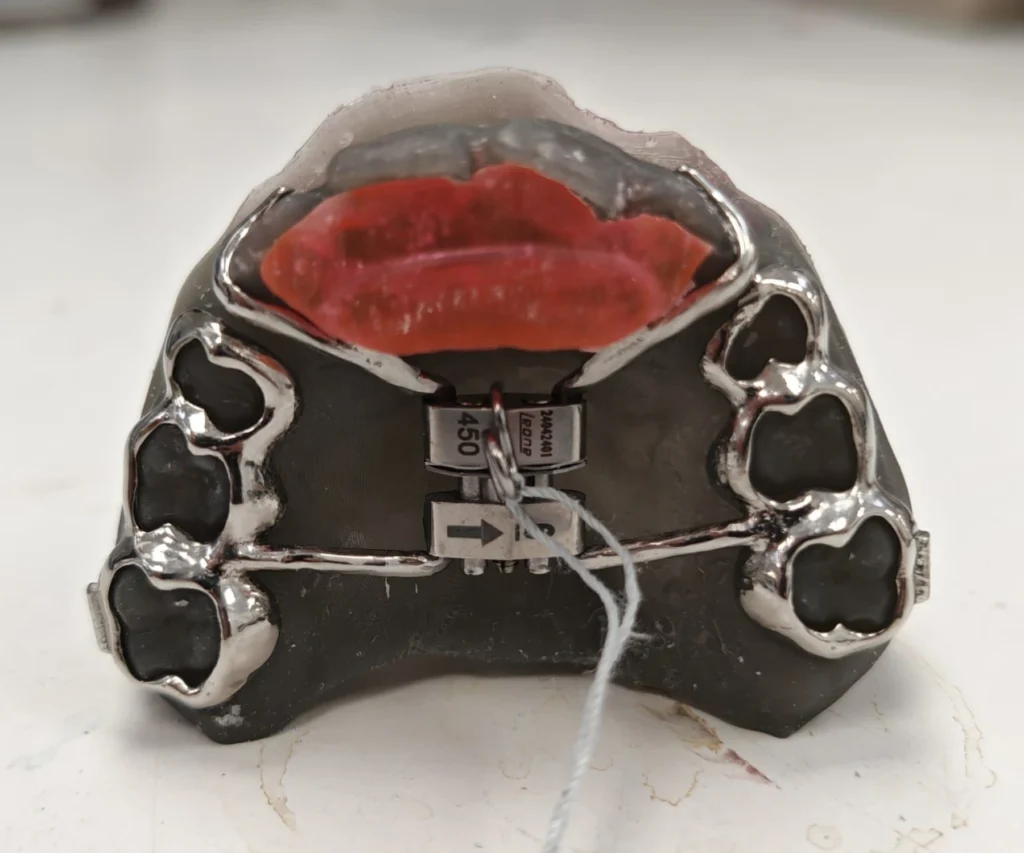 laboratoire dentaire dentotech bethune laboratoire dentaire dentotech bethune Appareils orthodontiques Laboratoire dentaire DENTOTECH à Béthune