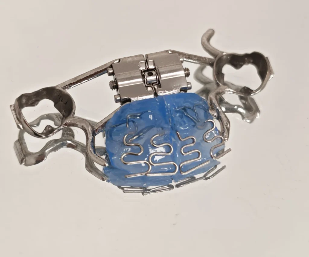 laboratoire dentaire dentotech bethune laboratoire dentaire dentotech bethune Appareils orthodontiques Laboratoire dentaire DENTOTECH à Béthune