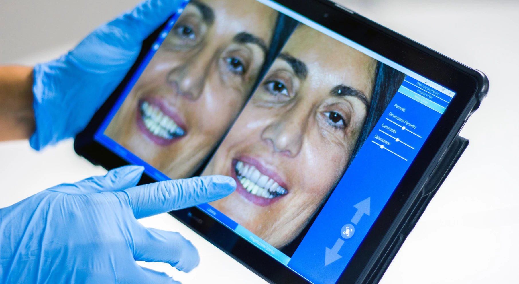 laboratoire dentotech bethune scaner