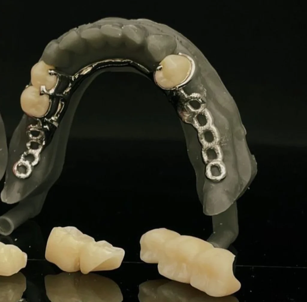 protheses adjointe amovibles dentotech bethune Notre métier Laboratoire dentaire DENTOTECH à Béthune