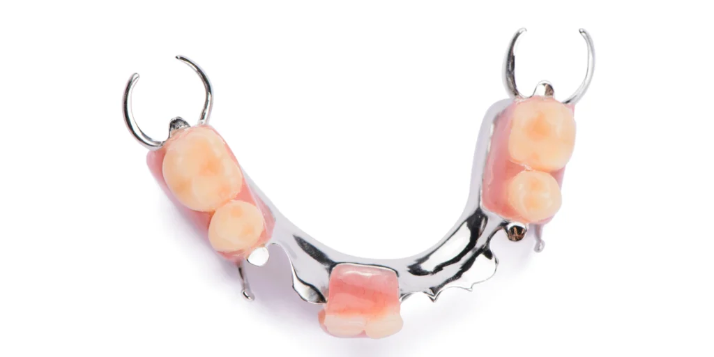 protheses adjointe dentotech bethune Prothèse adjointe Laboratoire dentaire DENTOTECH à Béthune