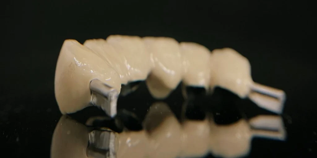 protheses adjointes amovibles dentotech bethune Prothèse adjointe Laboratoire dentaire DENTOTECH à Béthune