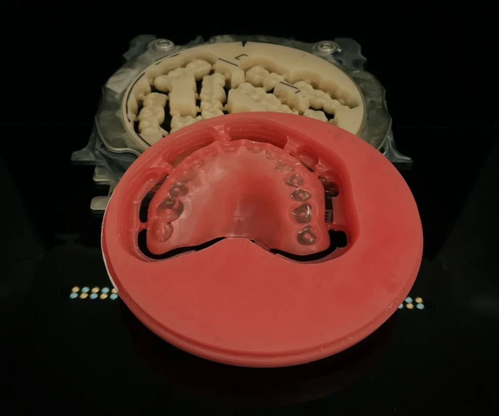 protheses conjointes fixes dentotech bethune Prothèse conjointe Laboratoire dentaire DENTOTECH à Béthune